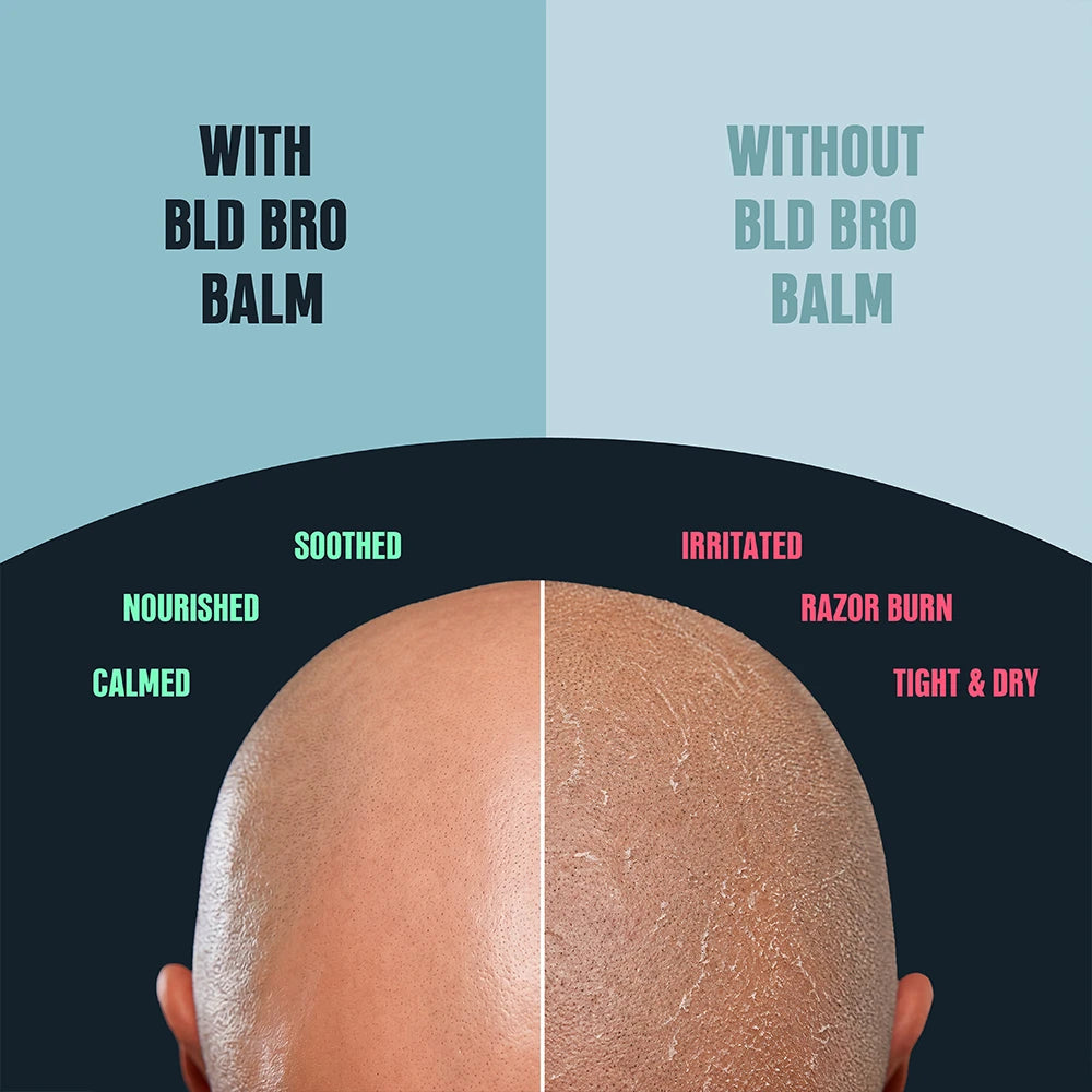 A split comparison graphic showing the back of a bald head with and without BLD Bro Balm. The left side, labeled 'WITH BLD BRO BALM,' shows a smooth, healed scalp with text reading 'SOOTHED,' 'NOURISHED,' and 'CALMED.