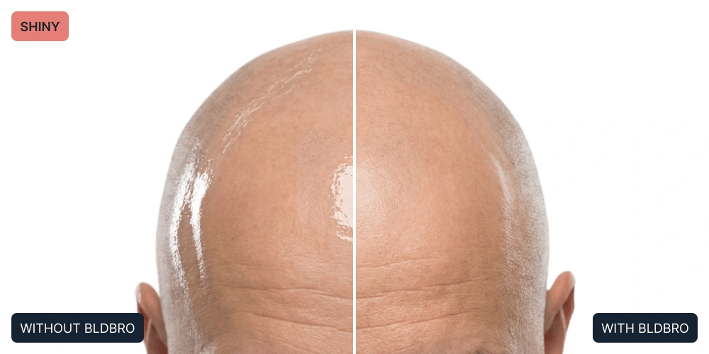 difference image