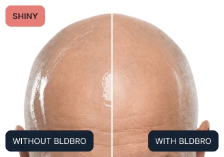 difference image