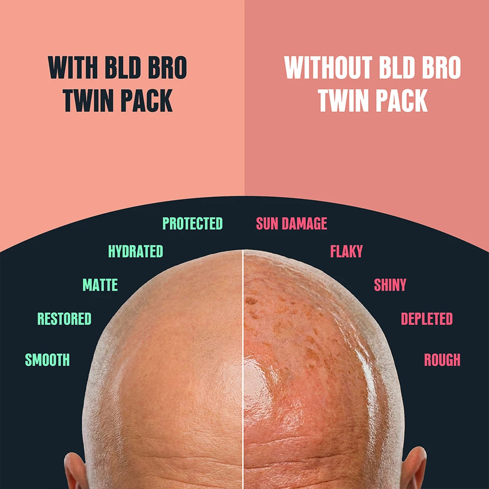 A promotional comparison graphic for a bald brother twin pack, showing a split view of a bald head with one side labeled 'WITH BLD BRO TWIN PACK' as smooth and protected, and the other side labeled 'WITHOUT BLD BRO TWIN PACK' as sun-damaged and rough.
