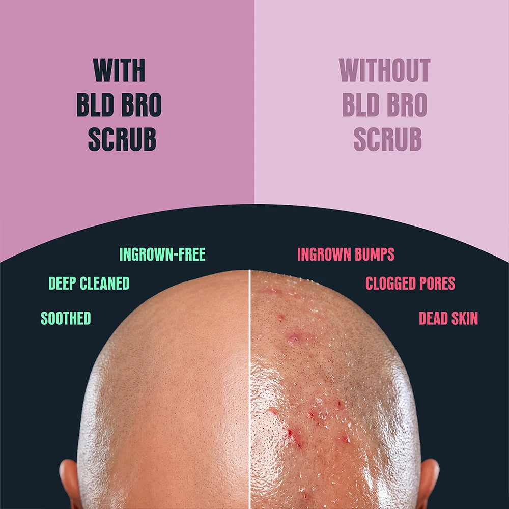 A before-and-after comparison graphic for a bald man's scalp, split down the middle with text overlays. The left side, labeled 'WITH BLD BRO SCRUB', shows a clean, treated scalp with green text listing benefits like 'INGROWN-FREE' and 'SOOTHED'.